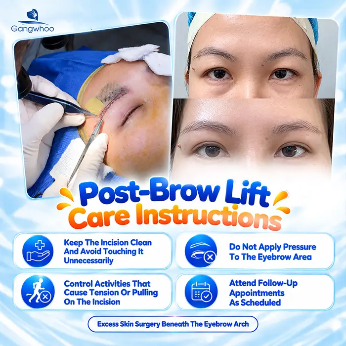 What Not to Eat After a Brow Lift? What to Eat to Support Recovery?
