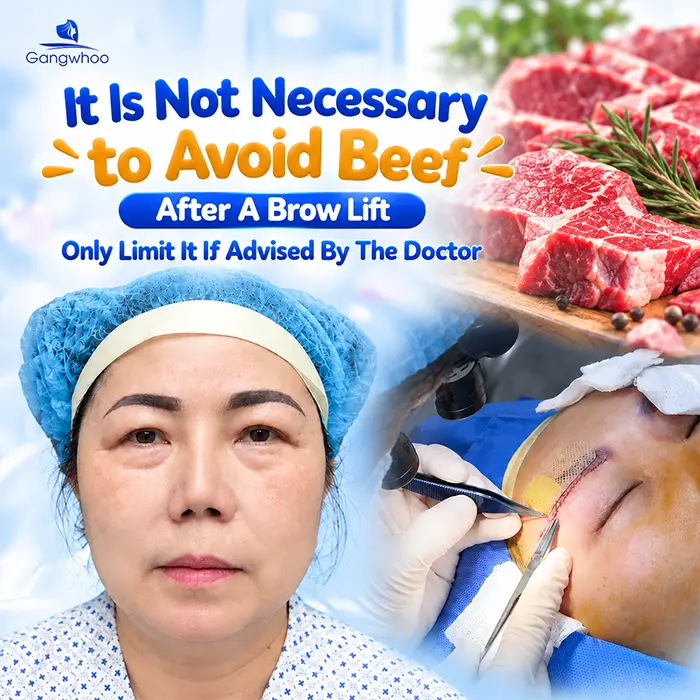 What Not to Eat After a Brow Lift? What to Eat to Support Recovery?