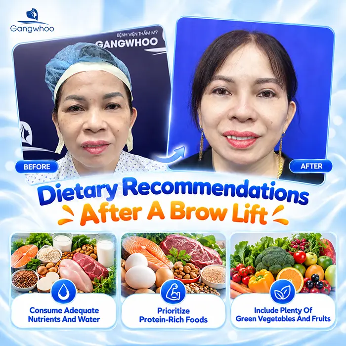 What Not to Eat After a Brow Lift? What to Eat to Support Recovery?